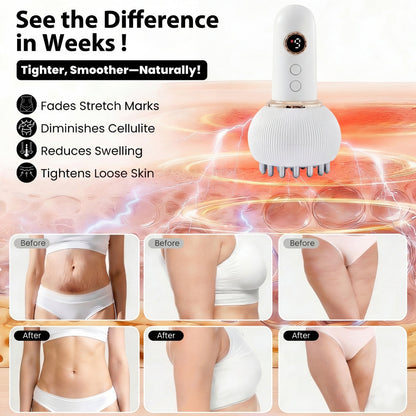 Cellulite & Lymphatic Drainage Massager